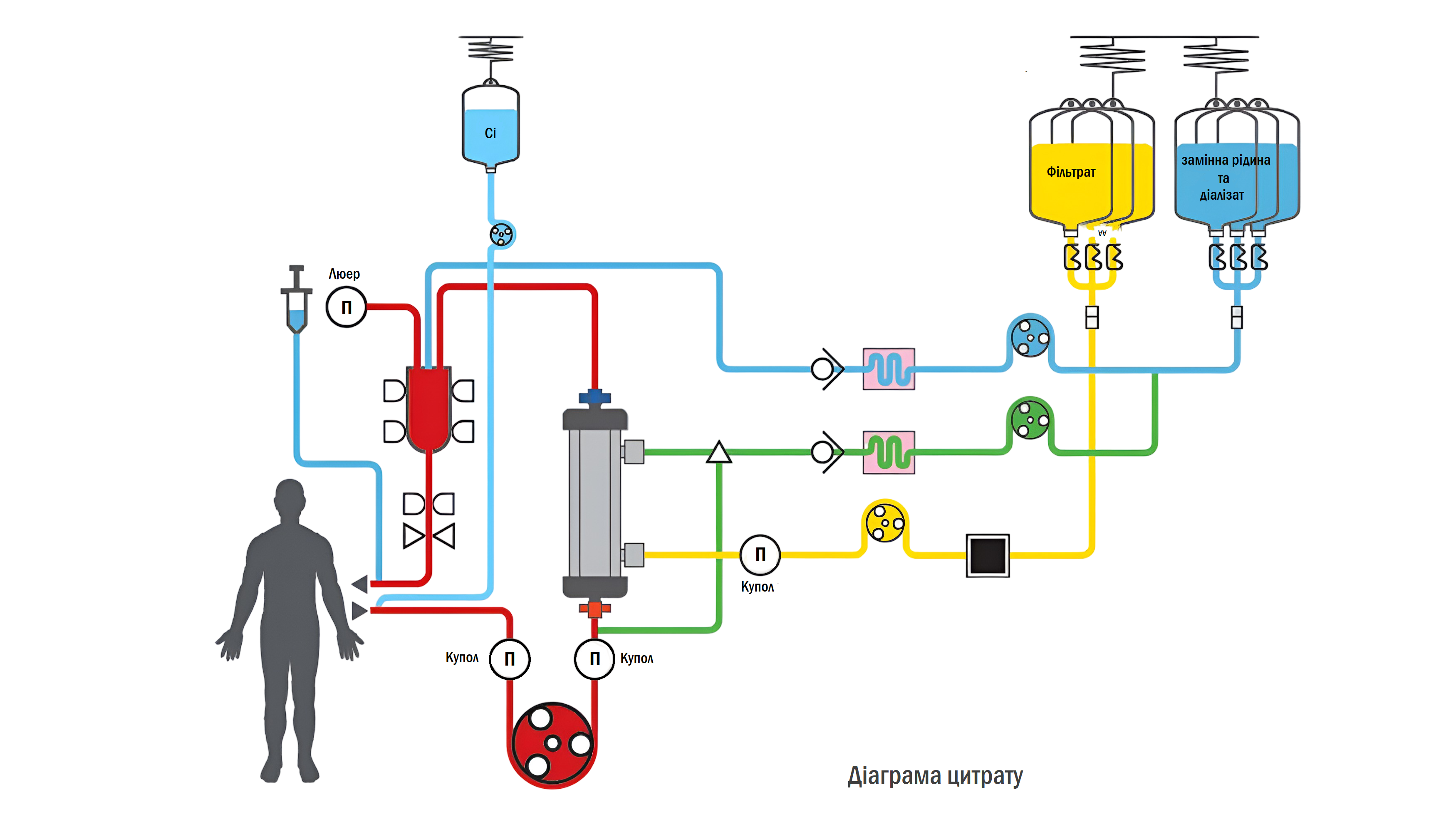 Apheresis AcuSmart Blanidas Комплектуючі для екстракорпоральної терапії Катетори для діалізу Гемоперфузія Безперервна замісна ниркова терапія Терапевтичний плазмаферез